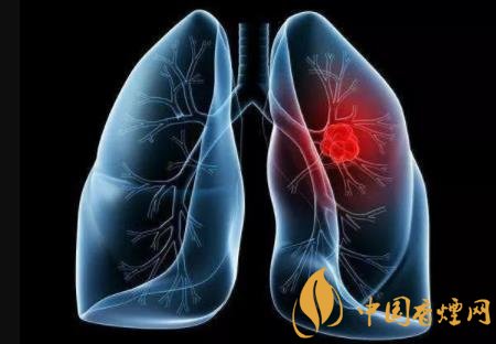 煙癮依賴是一種慢性病 戒煙需要專業(yè)指導(dǎo)